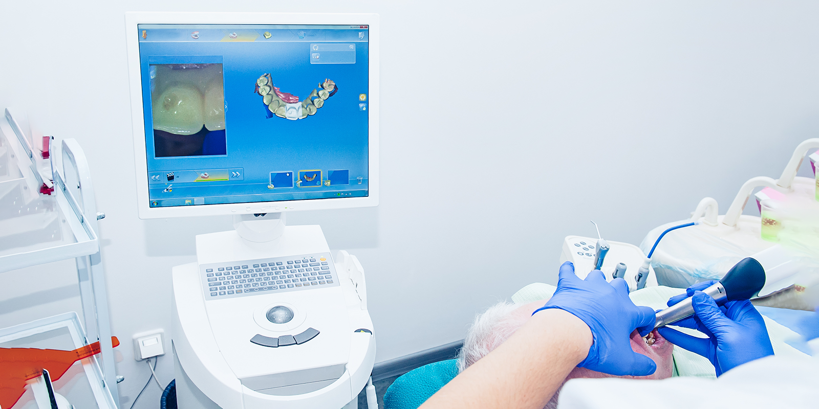 1dayトリートメント（1day治療）